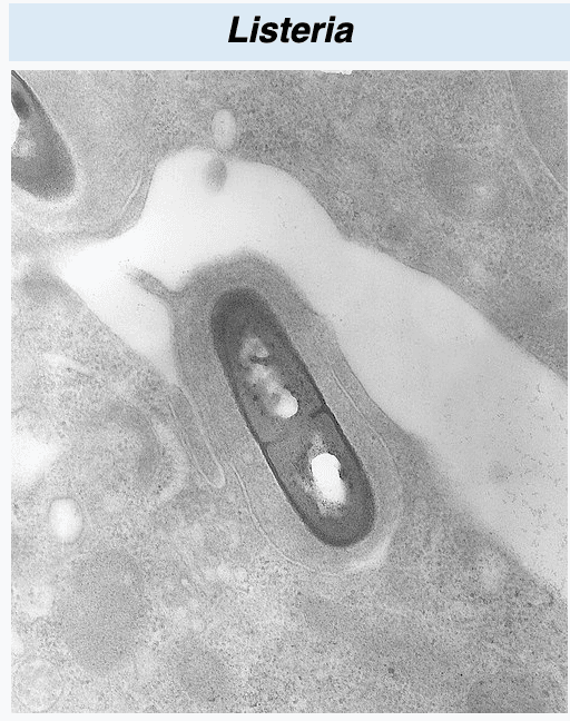 Listeria (กล้องจุลทรรศน์)